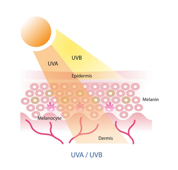 Psoralen and UVA (PUVA therapy)