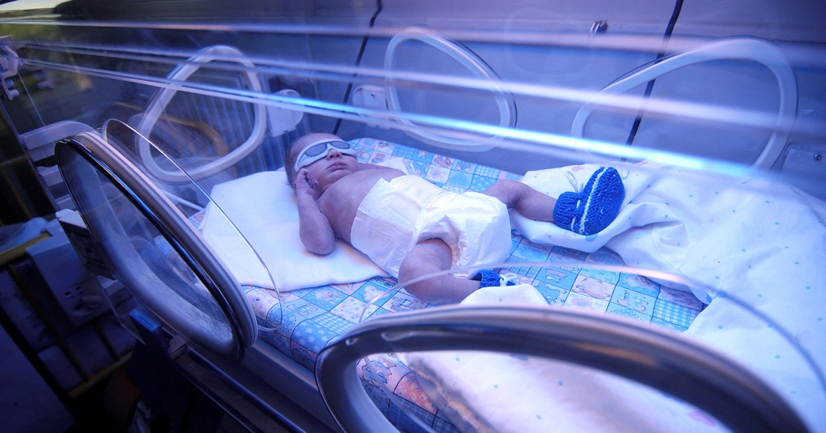 Bili Lights For Jaundice: Effectiveness For Neonatal & Adults