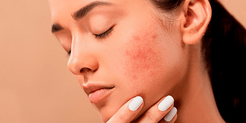 How to get rid of textured skin