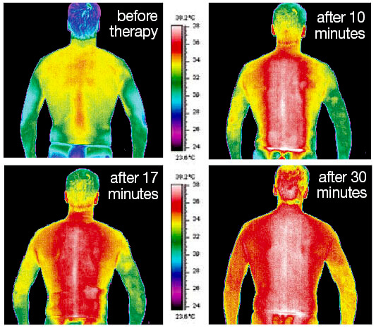 Infrared-heat