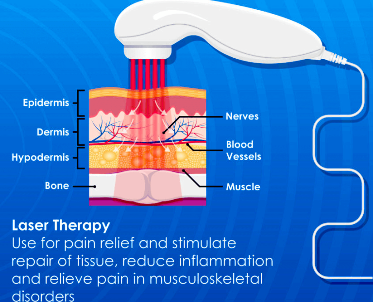4 Best Cold Laser Therapy Devices For Home Use Reviews [2023