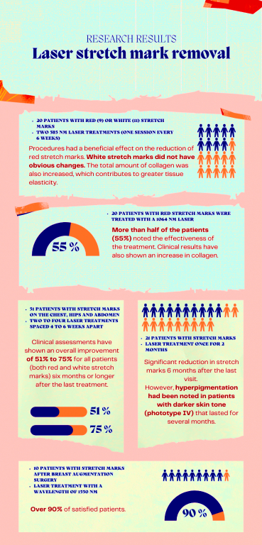 Research results of laser stretch mark removal