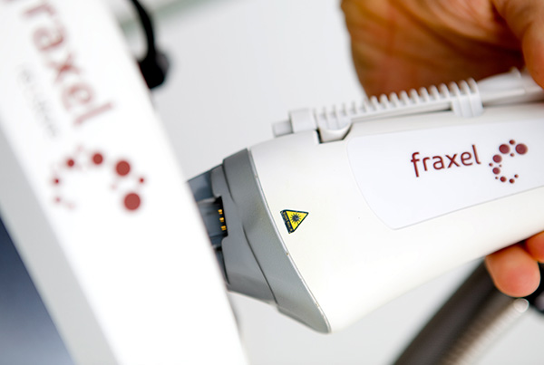 Fraxel laser treatment