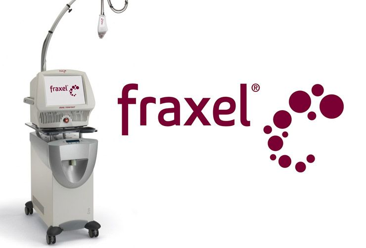 Fraxel laser