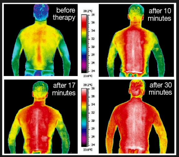 Before&After: Infrared sauna for fat burning