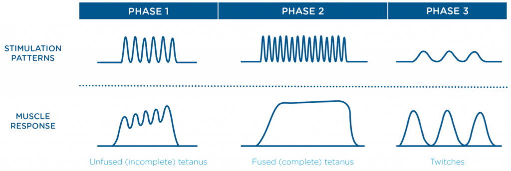 Phases of the EmSculpt muscle stimulation