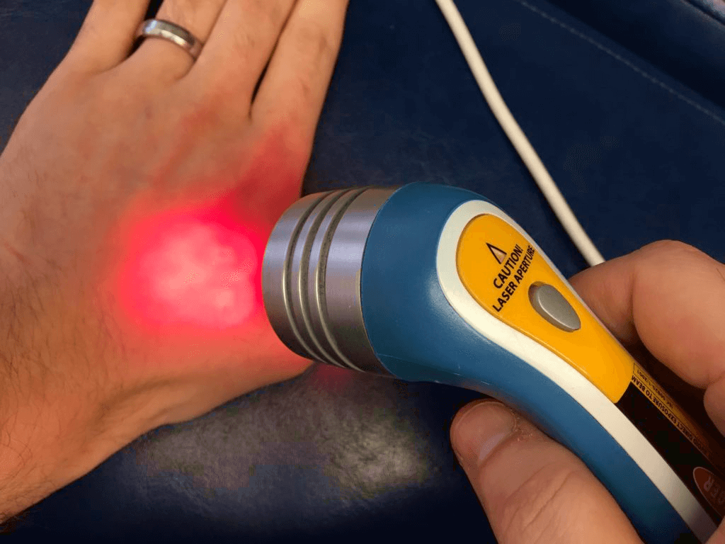 Myths and facts about cold laser therapy
