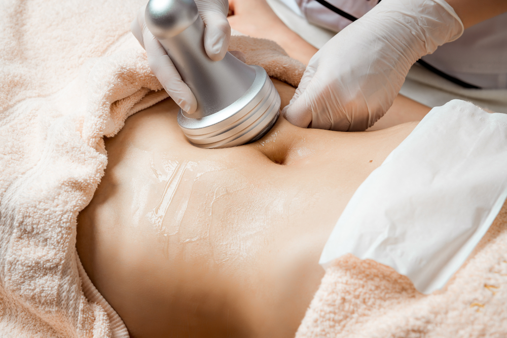 cavitation treatment