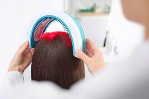 Red Light Therapy for Hair Growth
