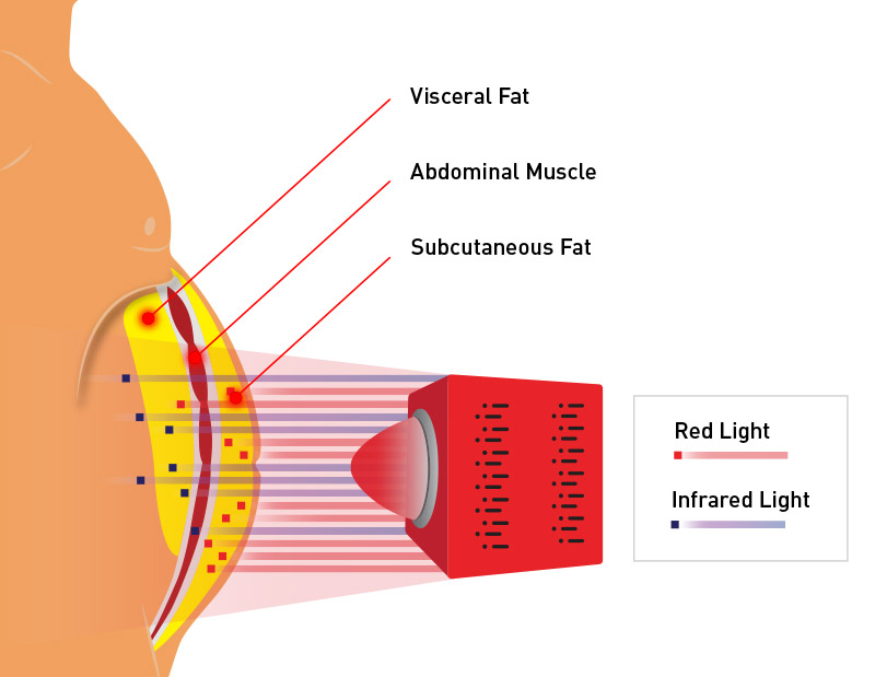 The impact of red & infrared light therapy on fat
