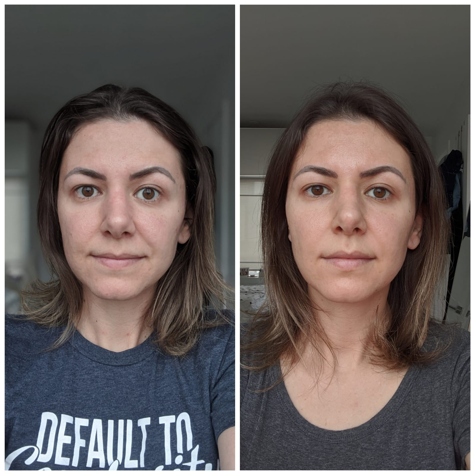 Before and after NuFace after 7 weeks of everyday use