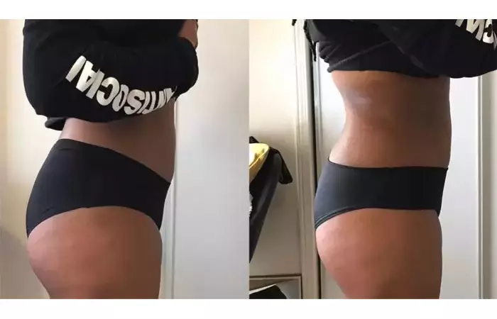 Results after 2 weeks of using fat-burning machines