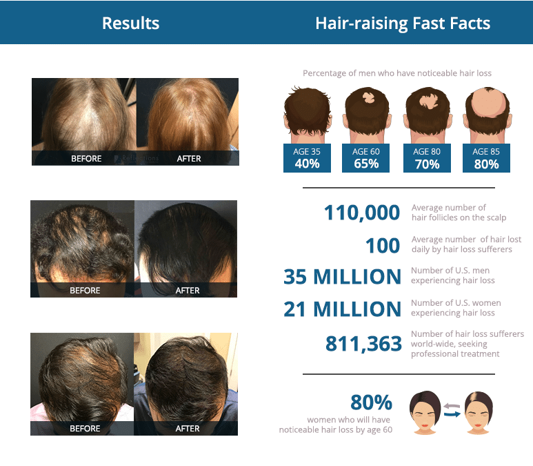 Results and hair-raising facts