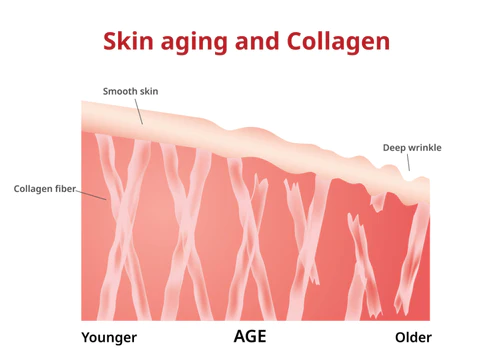 Skin aging and collagen