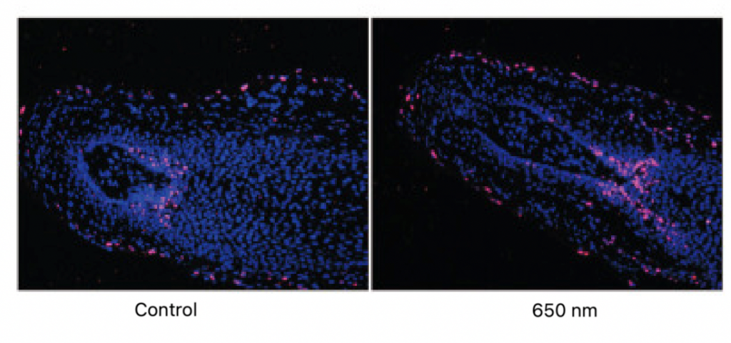 Hair shaft lengthening and cell proliferation in hair follicles with LLLT