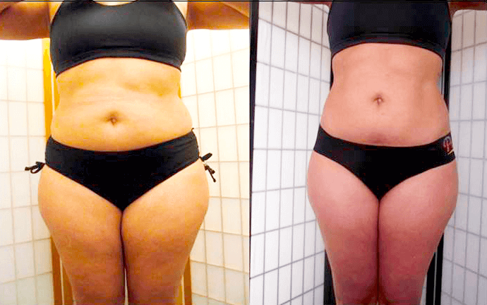 The result of using red light therapy devices for weight loss