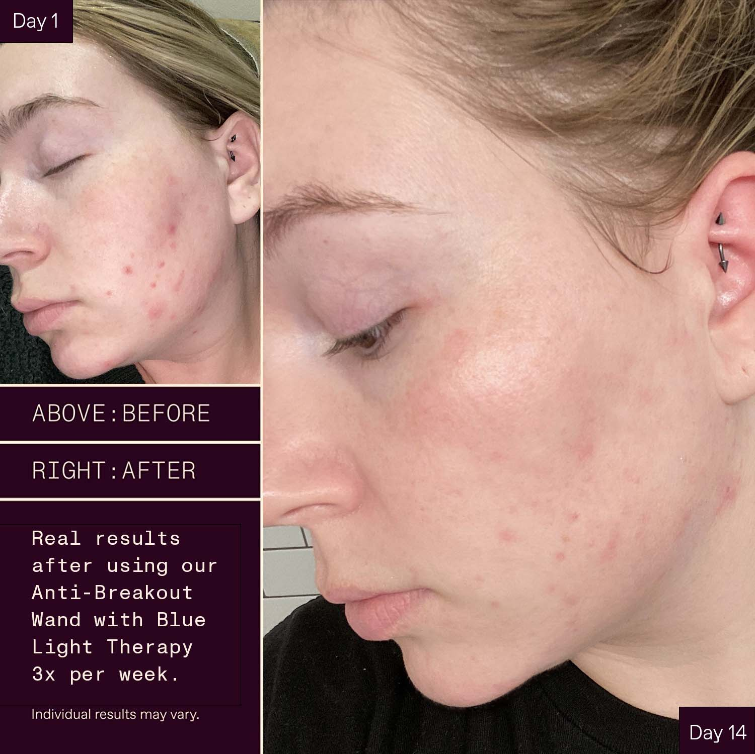 SolaWave Wands Reviews: Do They Work Magic on Your Skin? | Heliotherapy