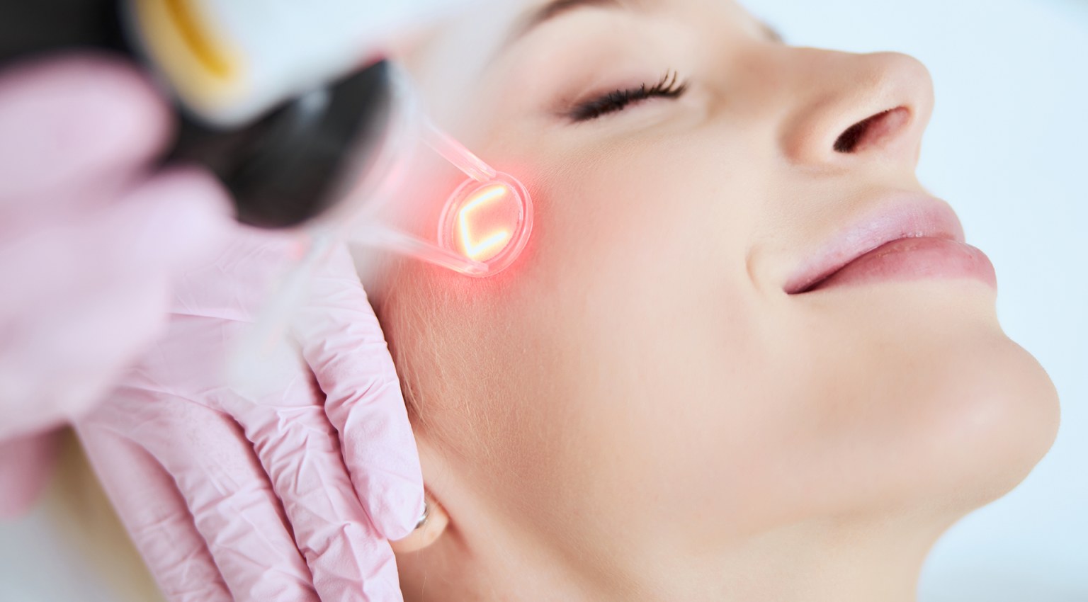 Laser Treatment for Rosacea 3 Best Tools [Before&After inc