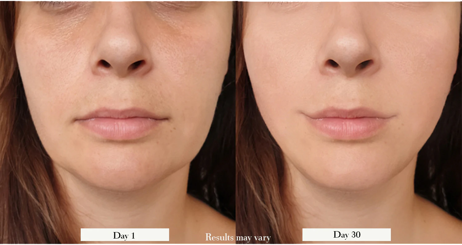 NuDerma Wand: Does It Really Work? Doctor’s Opinion + Reviews