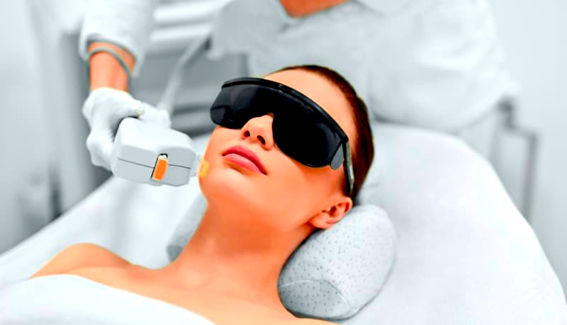 YAG laser