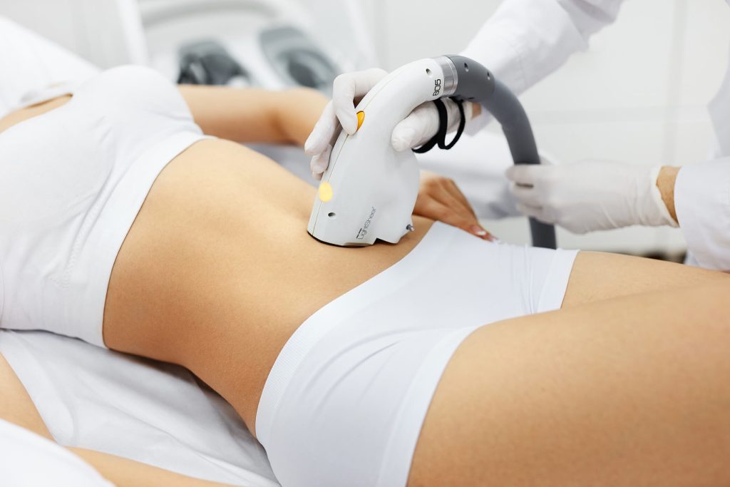  What to do before a laser hair removal