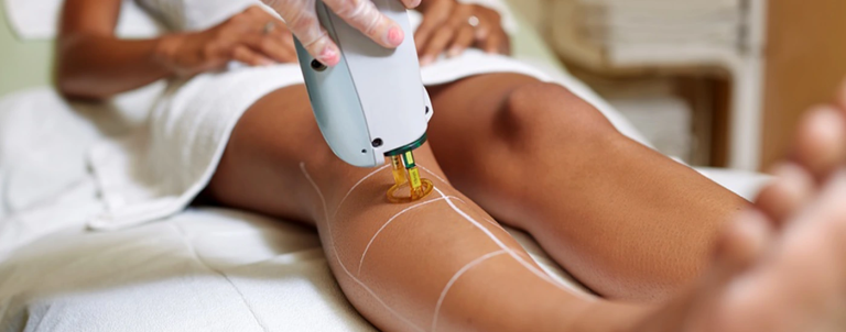 How long does laser hair removal take
